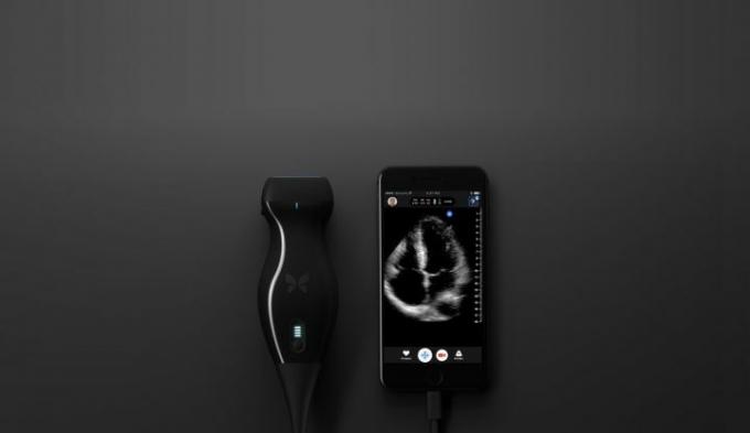 Un médecin a utilisé cet échographe iPhone pour diagnostiquer son propre cancer