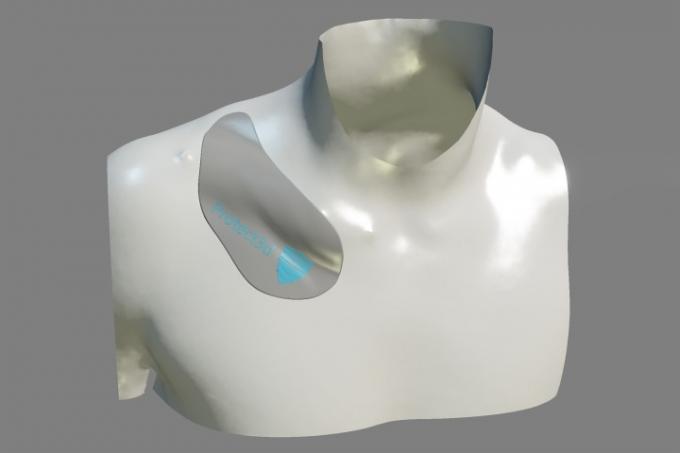 Protect3Ds 3D-printede kragebeinskinne.