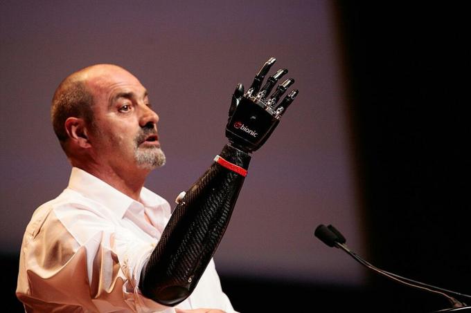 GE 2045 Nigel Ackland Bebionic3 인공 손 연단