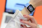 Egyes Apple Watch-felhasználók égési sérüléseket jelentettek