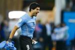 Suarez: Pers Uruguay mengatakan media mem-photoshop bekas gigitan saat meme muncul di Web