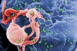 Biologi so uspešno odstranili HIV iz človeških imunskih celic