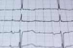Pentagon kan nå identifisere mennesker ved å måle hjerteslagene deres