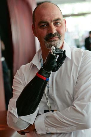 ge 2045 Nigel Ackland Bebionic3 인공 손