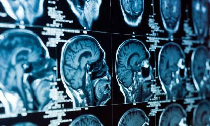 Bodo stranski skenerji možganov kmalu postali resničnost?