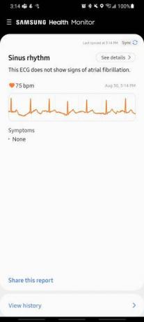 Sehen Sie sich die 4-EKG-App an.