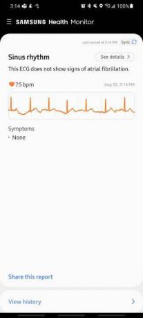 Urmăriți aplicația 4 ECG.