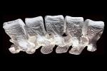 Hiperelastyczne kości wydrukowane w 3D mogą pomóc w leczeniu złamań