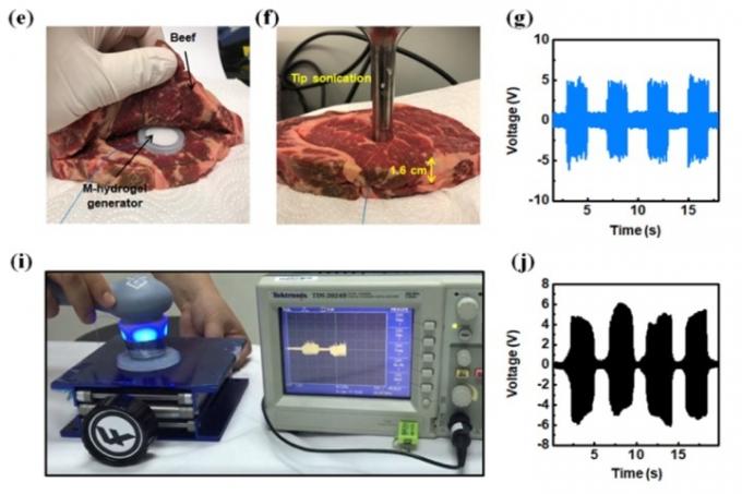 Ultrasunete bioelectrice 1