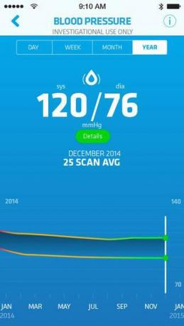 recensione di scanadu scout schermata ios 4